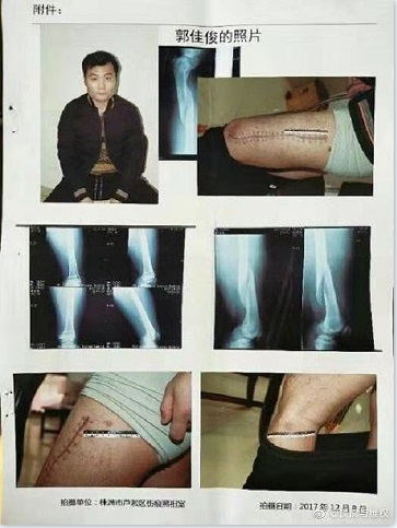 1615341016426664.png image.png